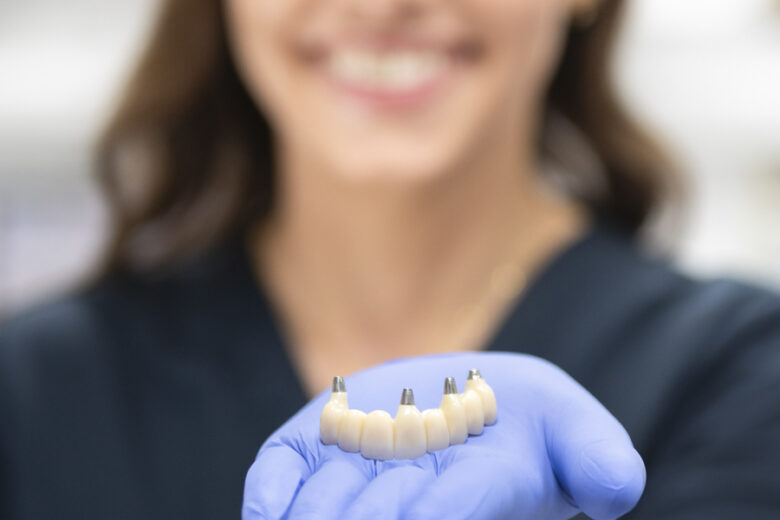 Protetyka na implantach